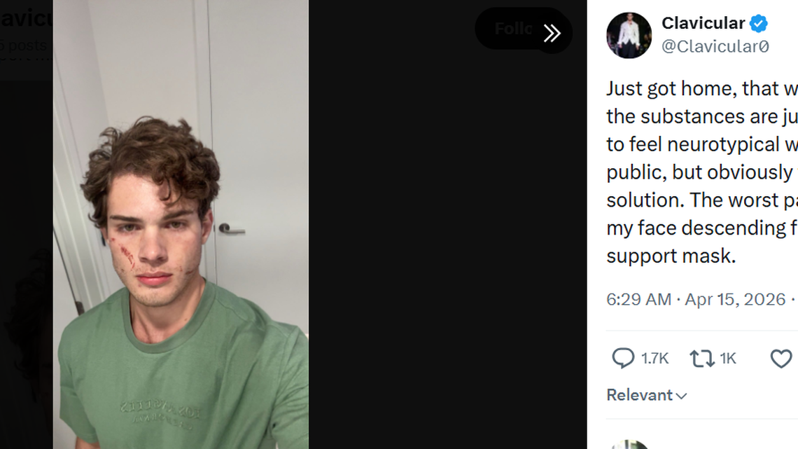 Online streamer and “looksmaxxer” Clavicular, aka Braden Peters Online streamer and “looksmaxxer” Clavicular, aka Braden Peters